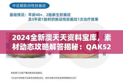 2024全新澳天天资料宝库,素材动态攻略解答揭秘:QAK520.71