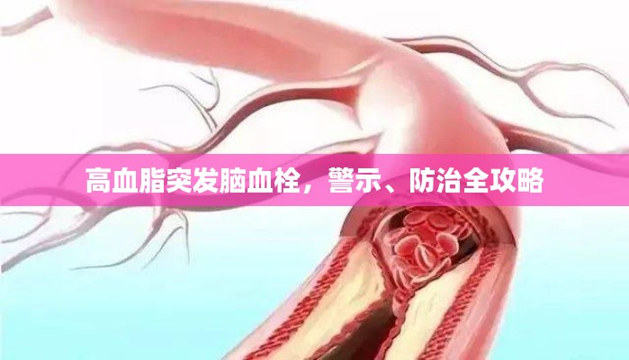 高血脂突发脑血栓，警示、防治全攻略